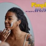 How to Remove Pimples Naturally and Permanently in Kenya (Home Guide 2026)