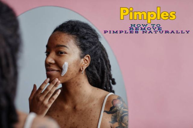 How to Remove Pimples Naturally and Permanently in Kenya (Home Guide 2026)